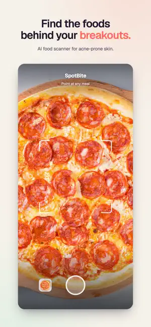 SpotBite: Acne Food Scanner screenshot 1