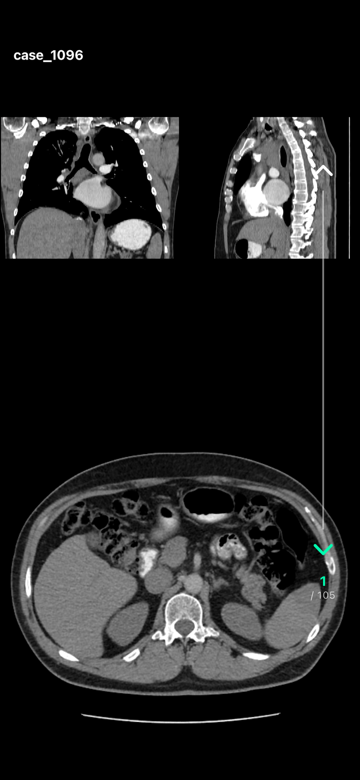 ScalarMetrics DICOM Viewer screenshot 4