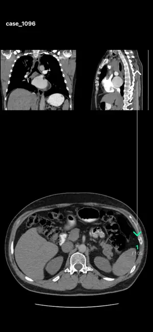 ScalarMetrics DICOM Viewer screenshot 3