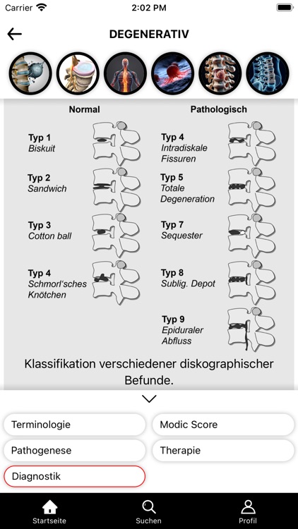 SpineGuide screenshot-3