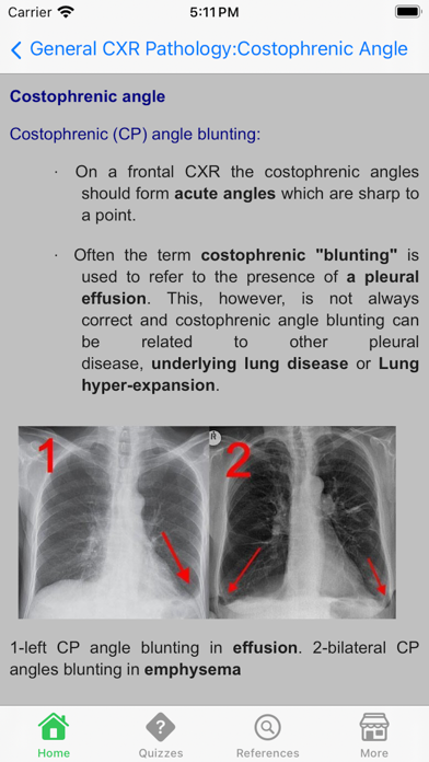 X-Ray Interpretation Guide Screenshot