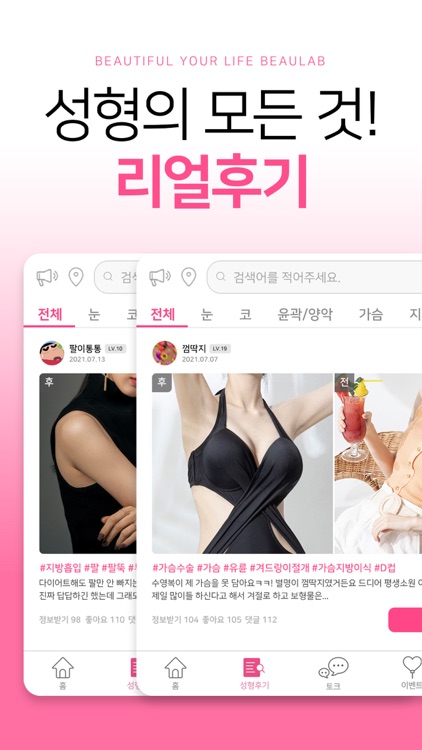 뷰랩 - 성형정보, 피부관리, 성형&시술후기를 한번에! screenshot-3