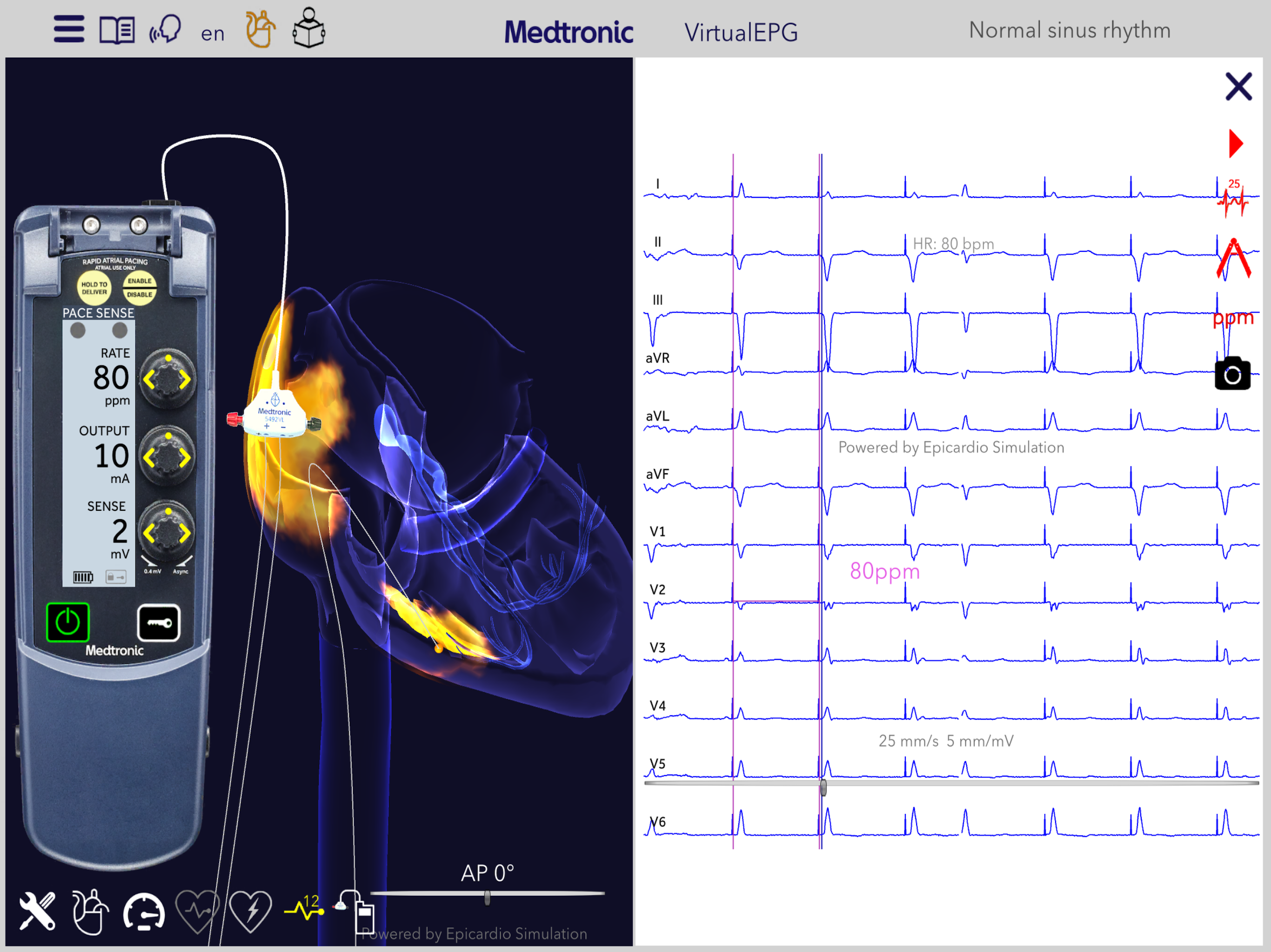 Medtronic VirtualPulse screenshot 20