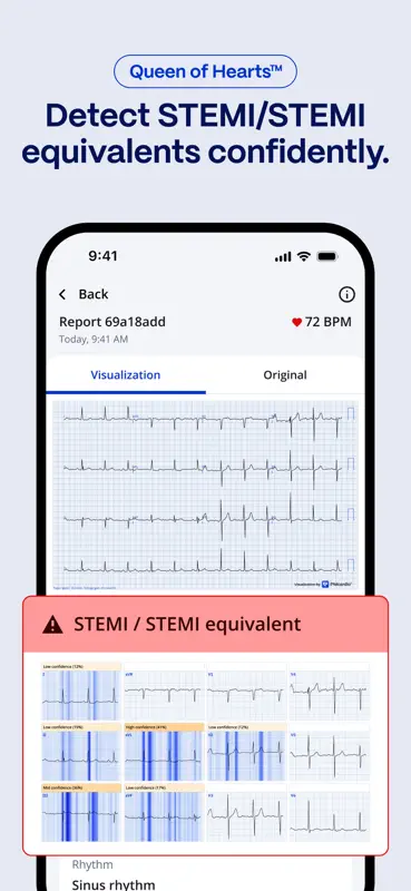 PMcardio for Individuals screenshot 2 of 4