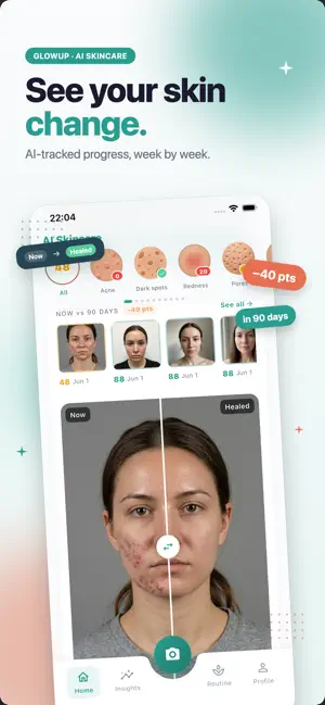 AI Skincare: Scan & Track screenshot 1