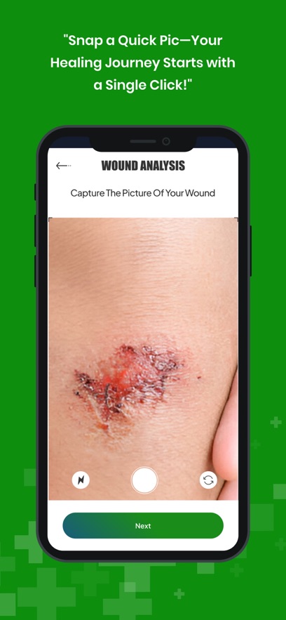 WoundWise