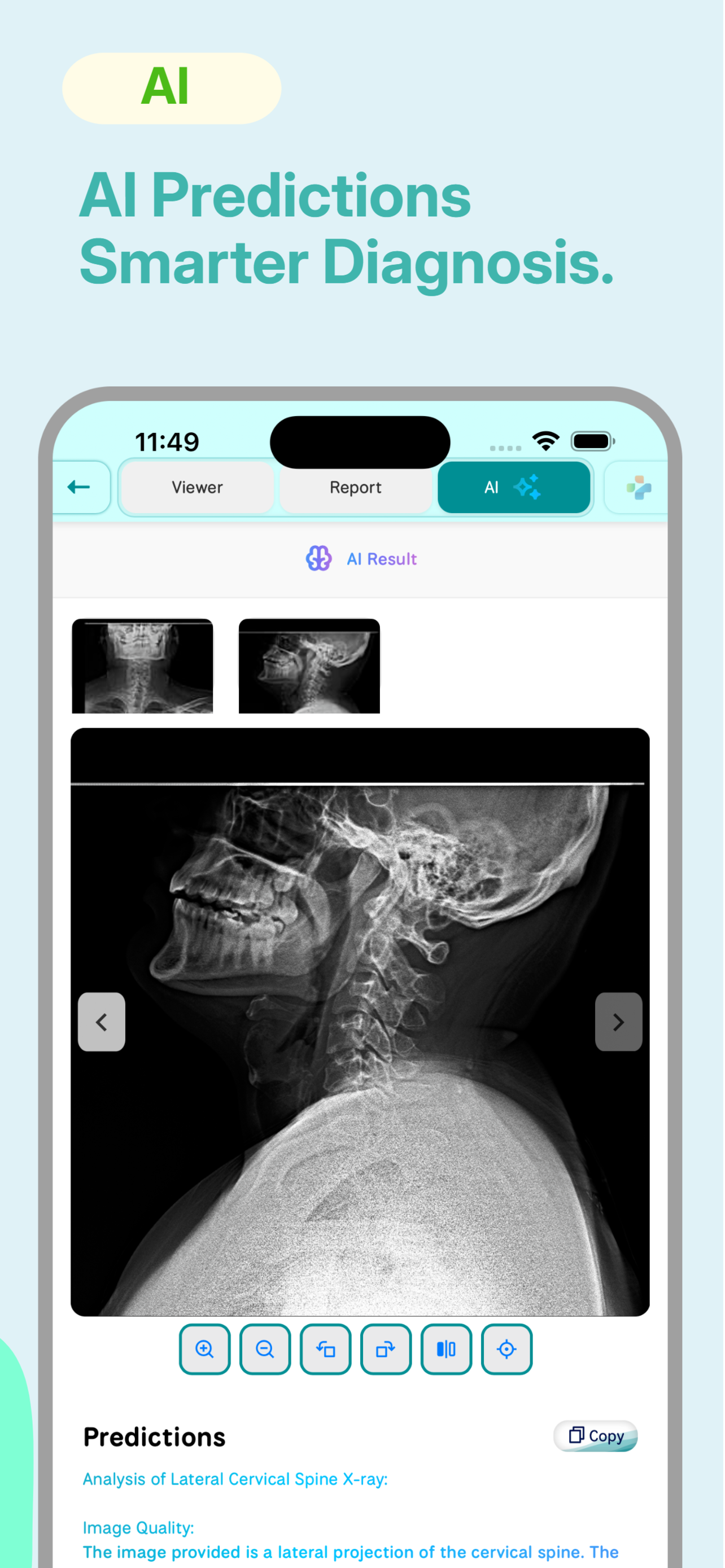 RadpicsAI screenshot 3