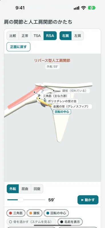 肩関節モデル screenshot 1 of 4