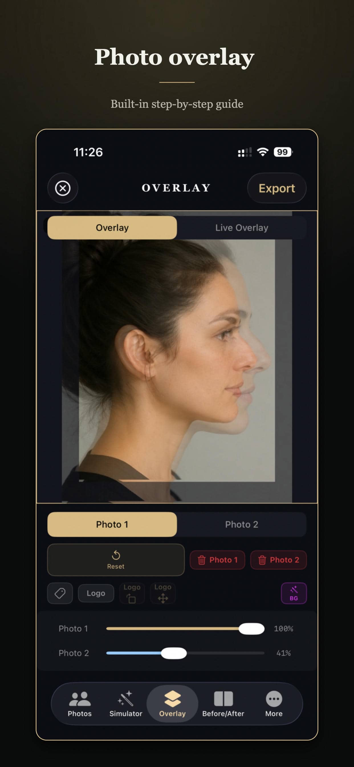 Rhinoplasty Simulator Pro screenshot 5