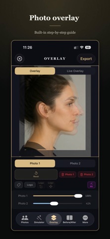 Rhinoplasty Simulator Pro Screenshot 5 of 6