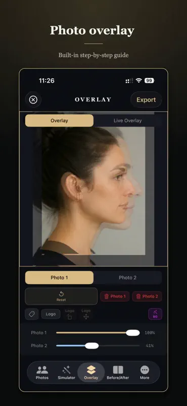 Rhinoplasty Simulator Pro screenshot 5 of 6