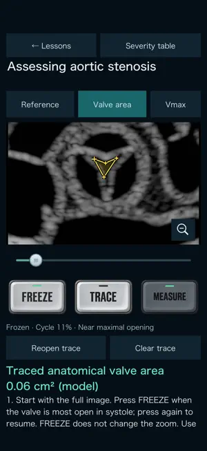 Cardiac Ultrasound Trainer screenshot 4