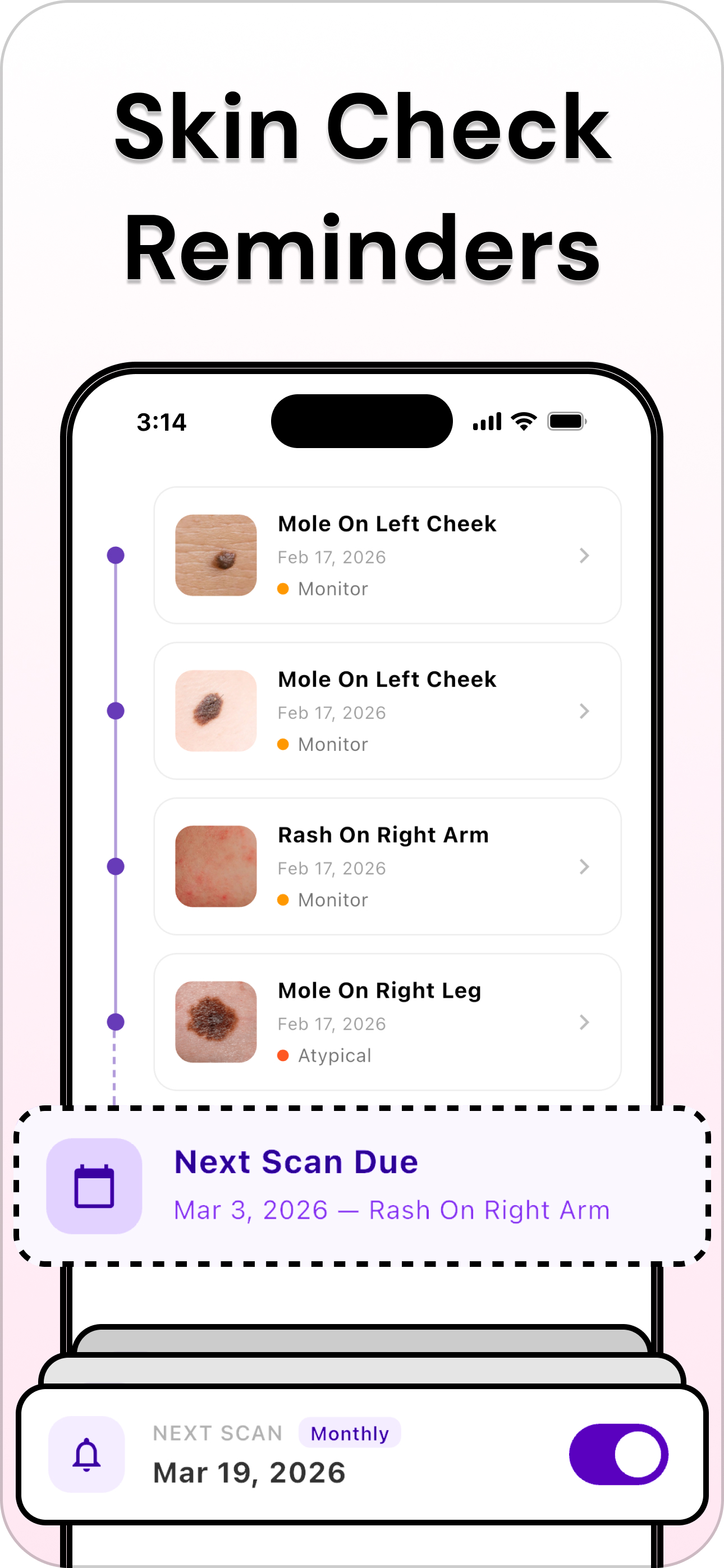 Mole Checker - SkinLog screenshot 4