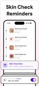 Mole Checker - SkinLog screenshot