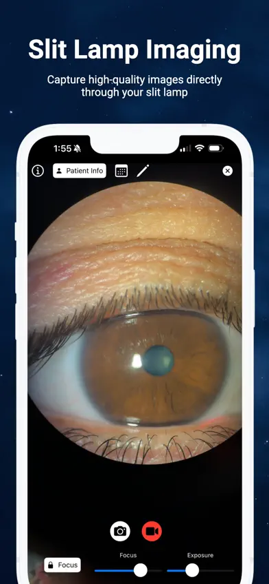 Slit Lamp Camera screenshot 1