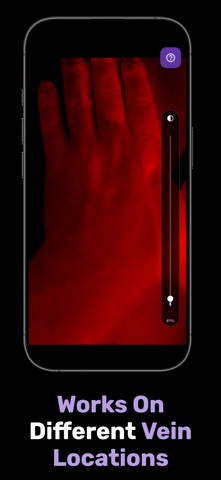 X-Vein screenshot 2