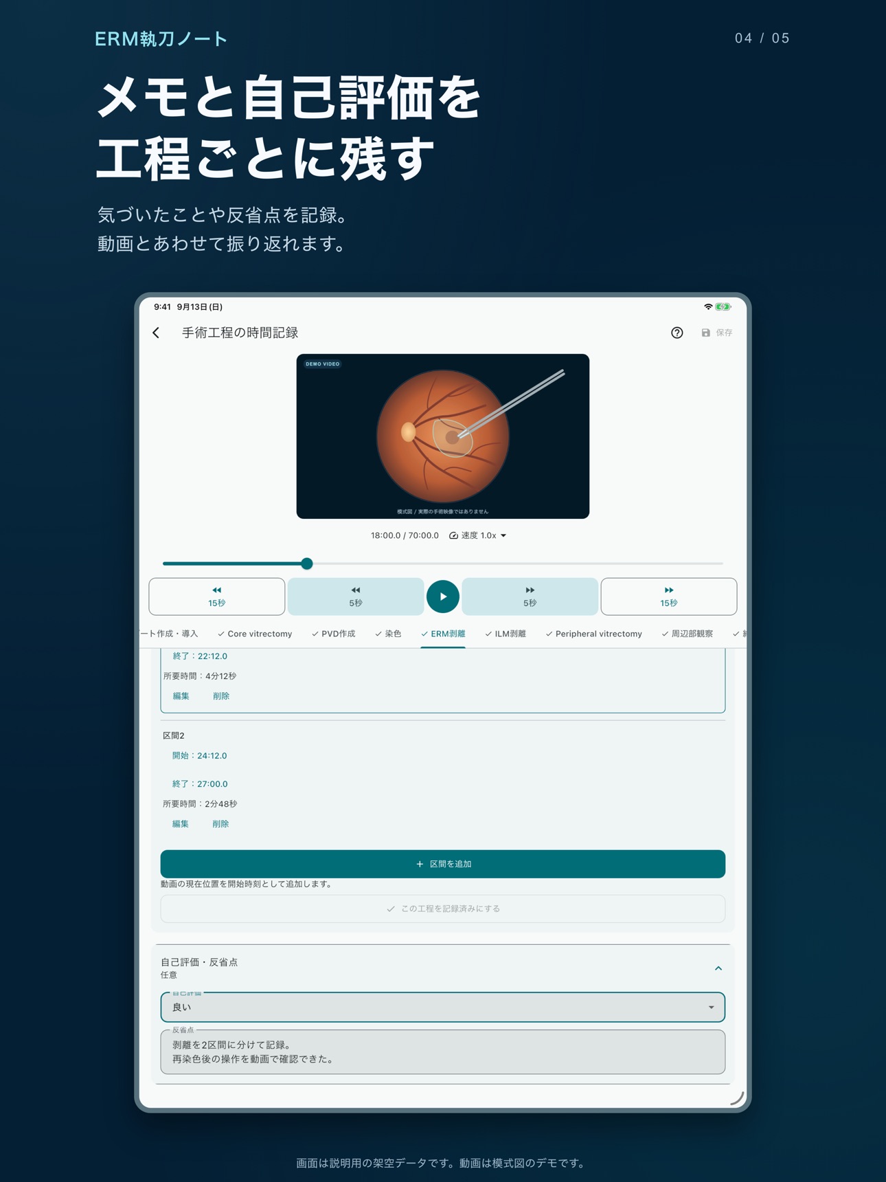Screenshot 9 of ERM執刀ノート