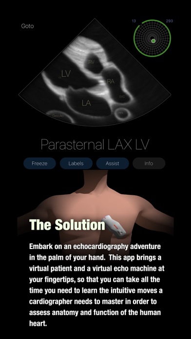 TTE PoCUS Simulator Screenshot