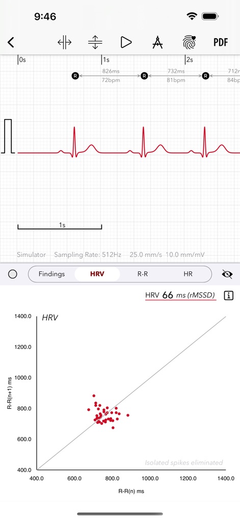 ECG+ | Your Watch ECG Reader - L'application offre une visualisation graphique de la VFC via le diagramme de Poincaré et quantifie la mesure de la rMSSD pour évaluer la capacité de récupération du corps.
