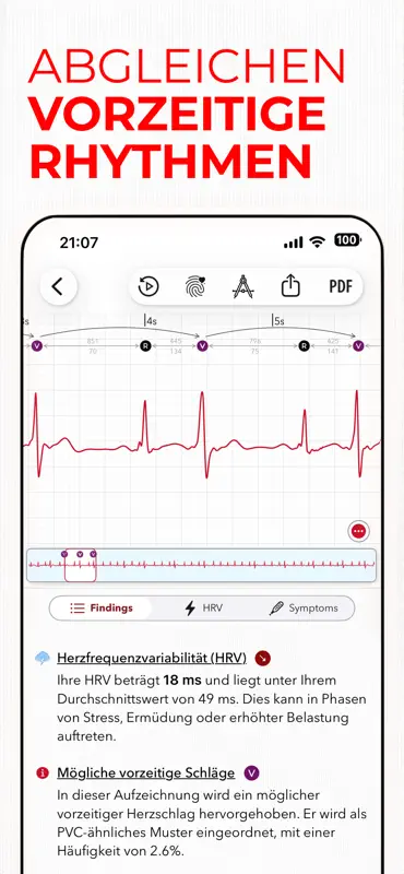 ECG+ | Your Watch ECG Reader screenshot 3 of 10