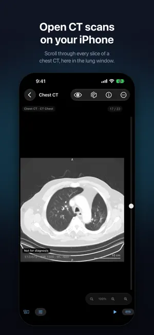 Voxelis: DICOM Viewer CT & MRI screenshot 1
