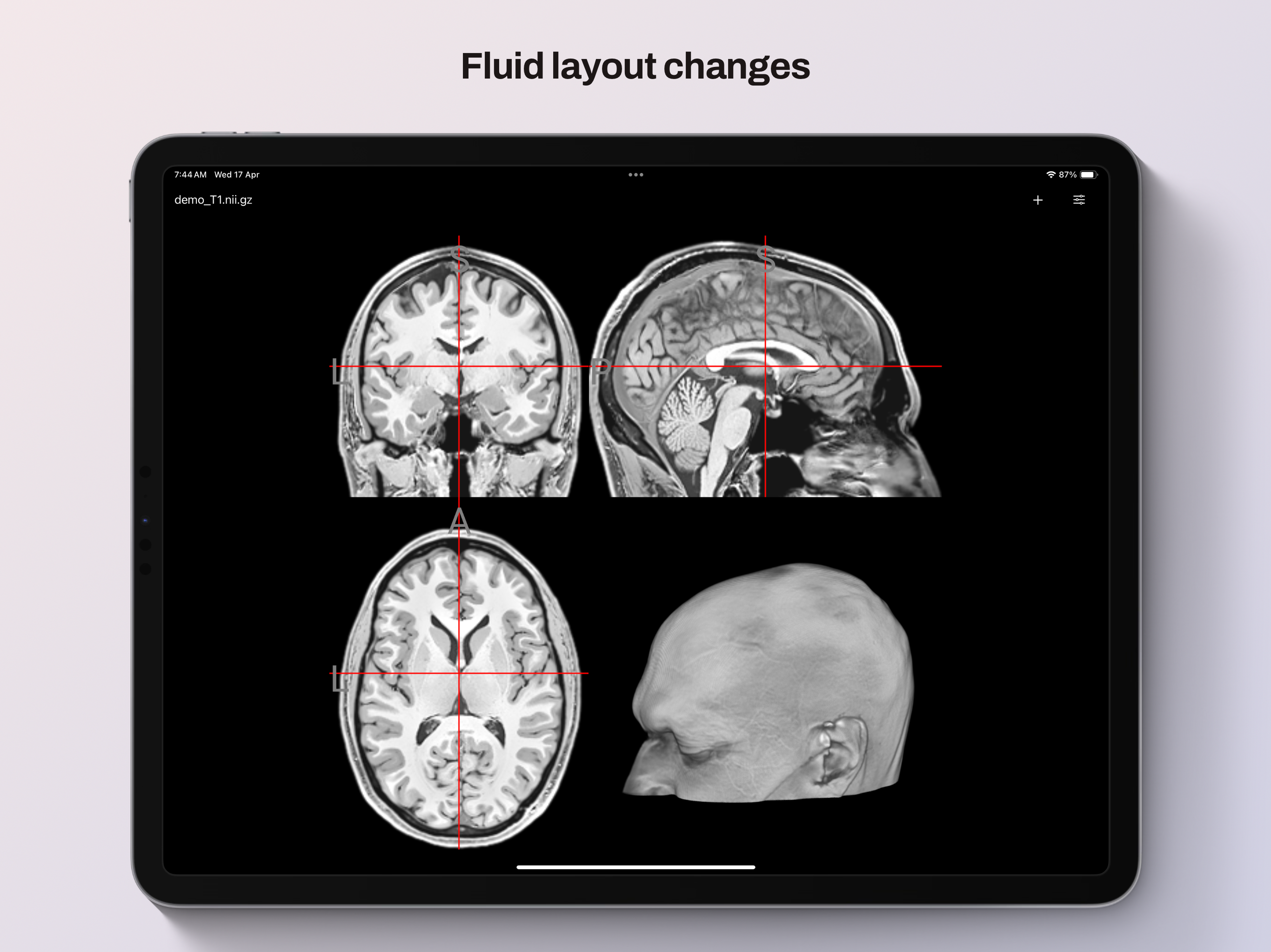 NiiVue screenshot 6