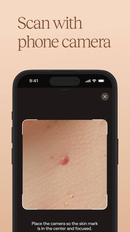 Oteria - Skin Cancer Check