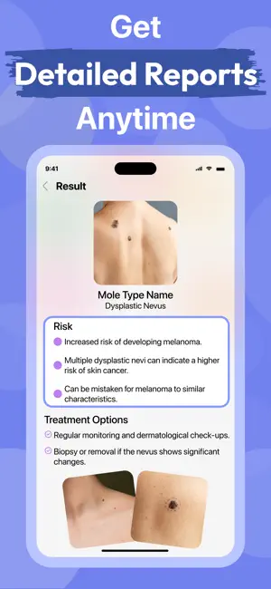 AI Skin Care Scanner・Acne Safe screenshot 2