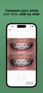 My Braces Tracker screenshot 4