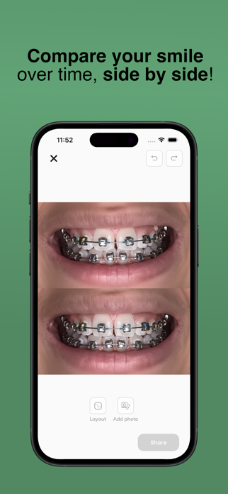 My Braces Tracker Screenshot 4 of 4