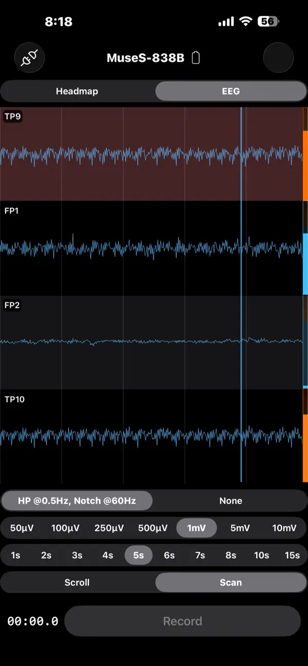 Screenshot #1 pour EEG Recorder
