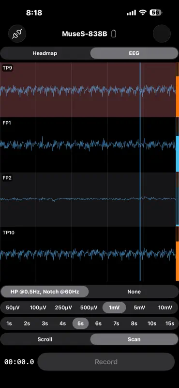 EEG Recorder screenshot 1 of 7