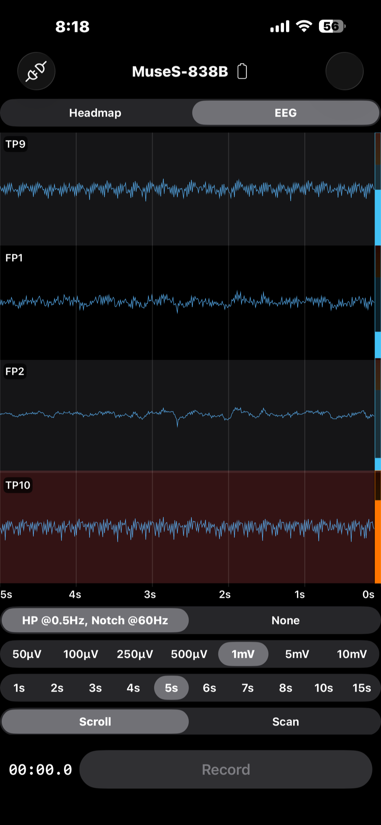 EEG Recorder