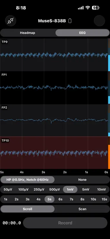 EEG Recorder screenshot 4 of 7