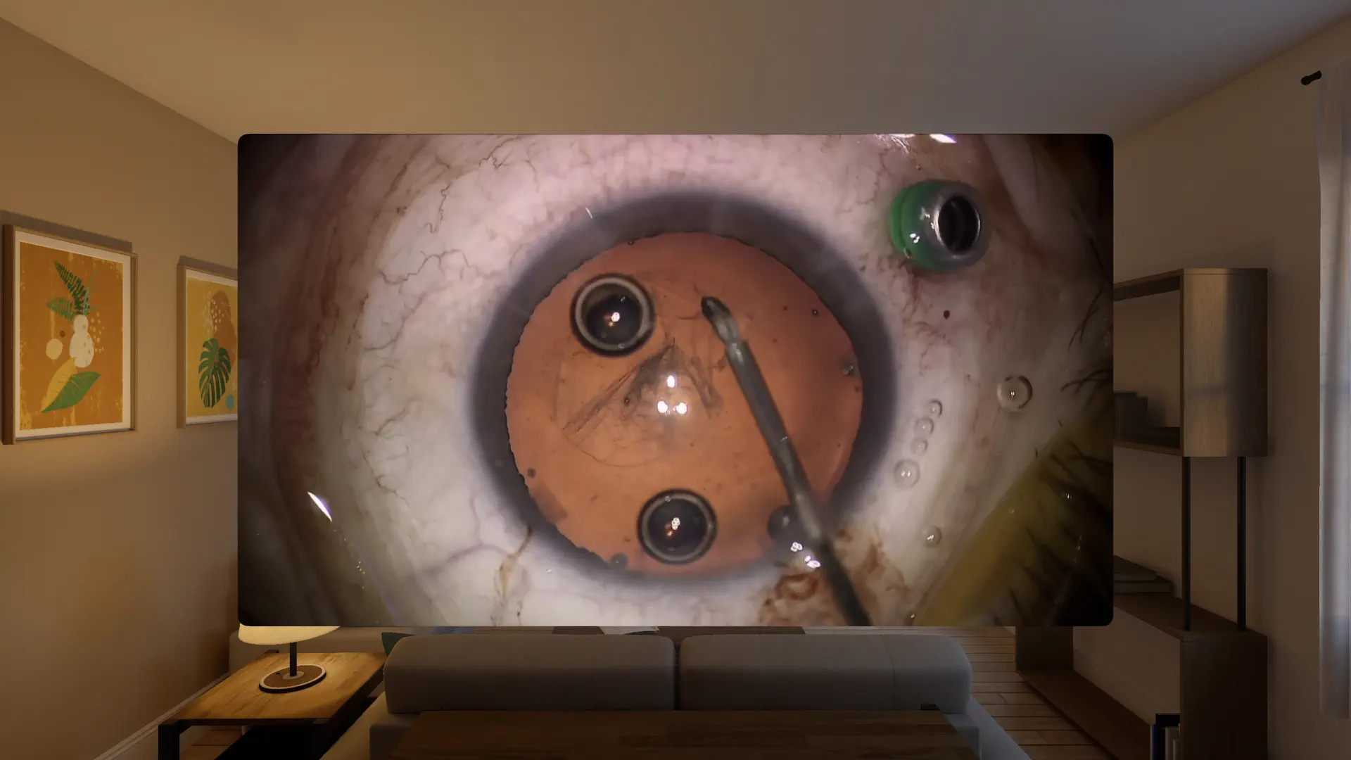 ZEISS Surgery Optimizer screenshot 5