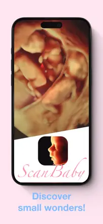 ScanBaby learn baby ultrasound: Screenshot 1 von 8