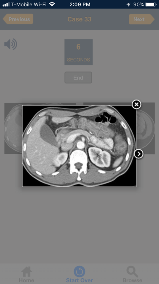 #3. CTisus 10 Minute ER Challenge (iOS) Podle: Elliot Fishman