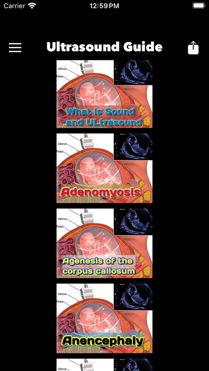 Ultrasound Guide Case Studies