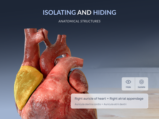 VOKA 3D Anatomy & Pathology iPad screenshot 5 - Medical app