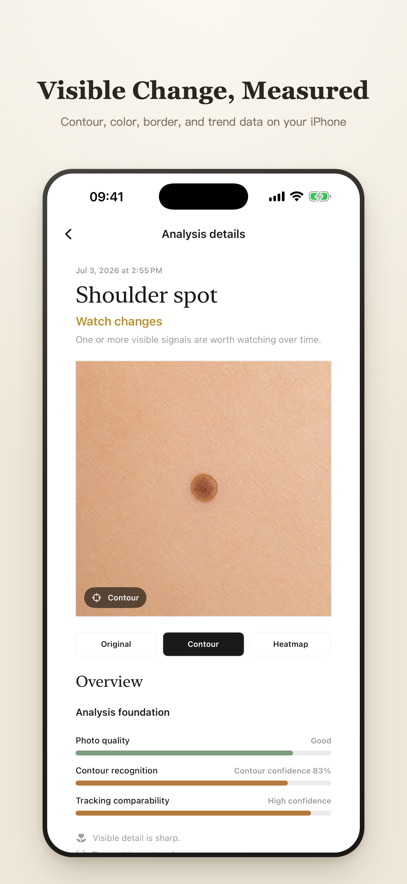MoleTrail: Mole & Spot Tracker screenshot 4