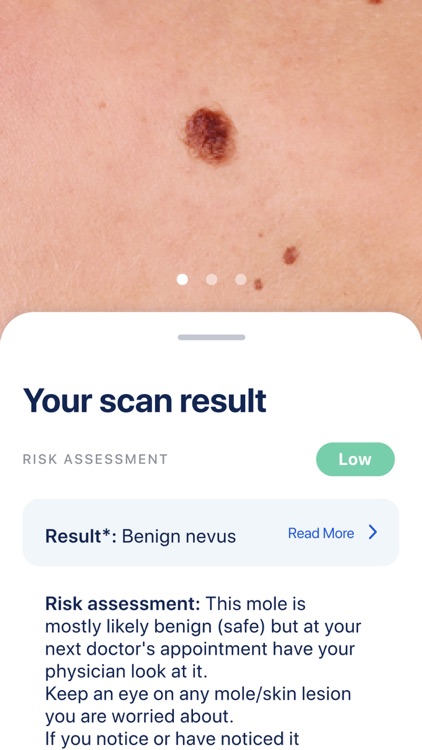 Skinner: Analyze your skin screenshot-5