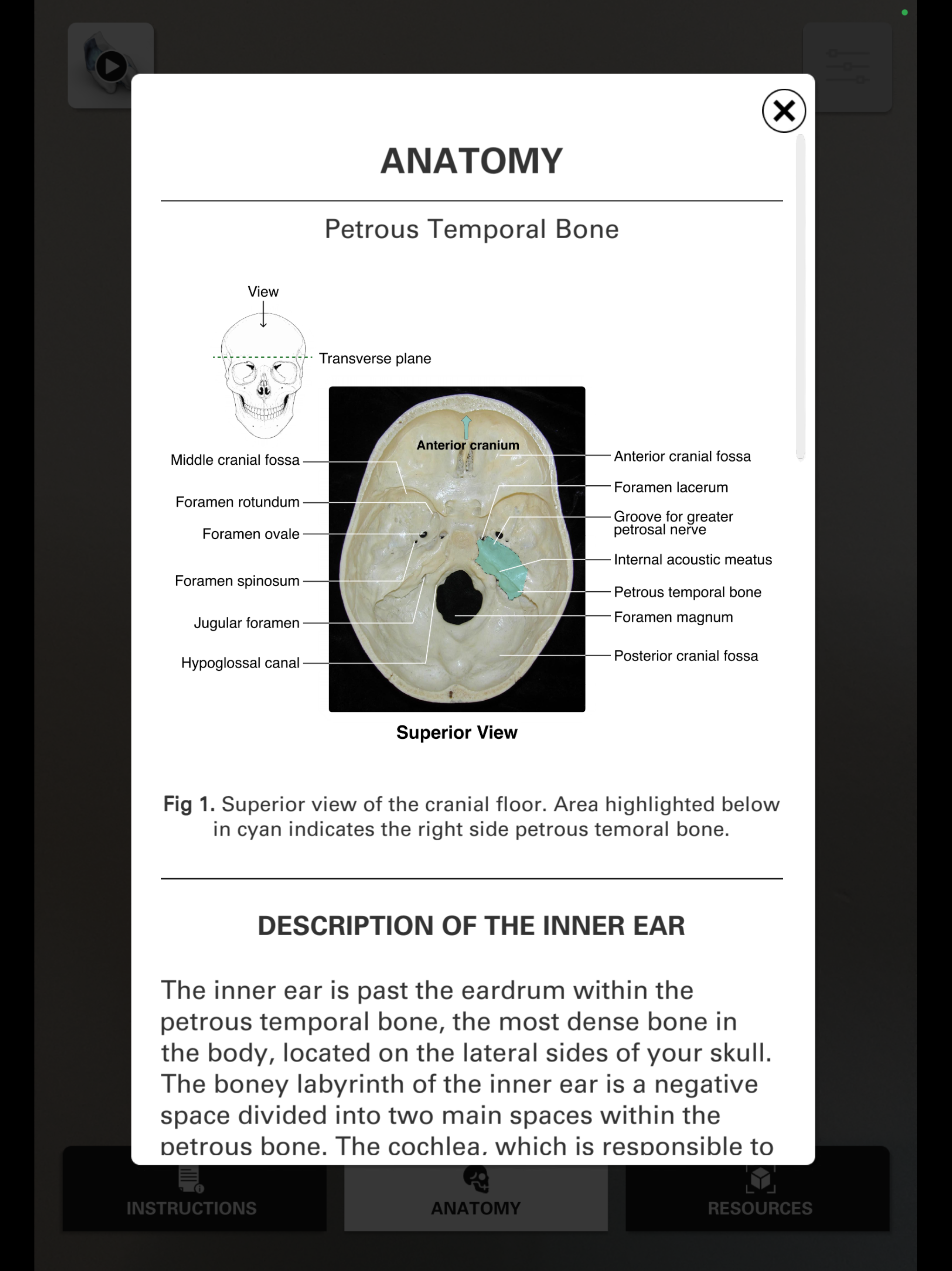 InvisibleEar screenshot 10