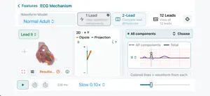 ECG Vector screenshot 1