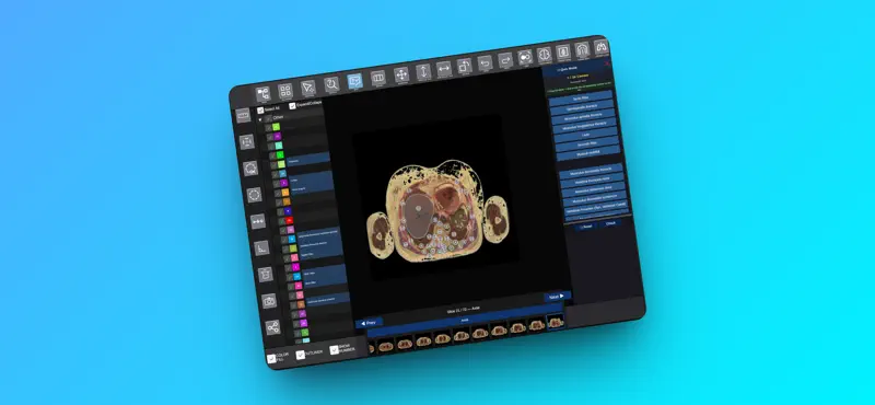 INTERACTIVE MRI ATLAS screenshot 8 of 8
