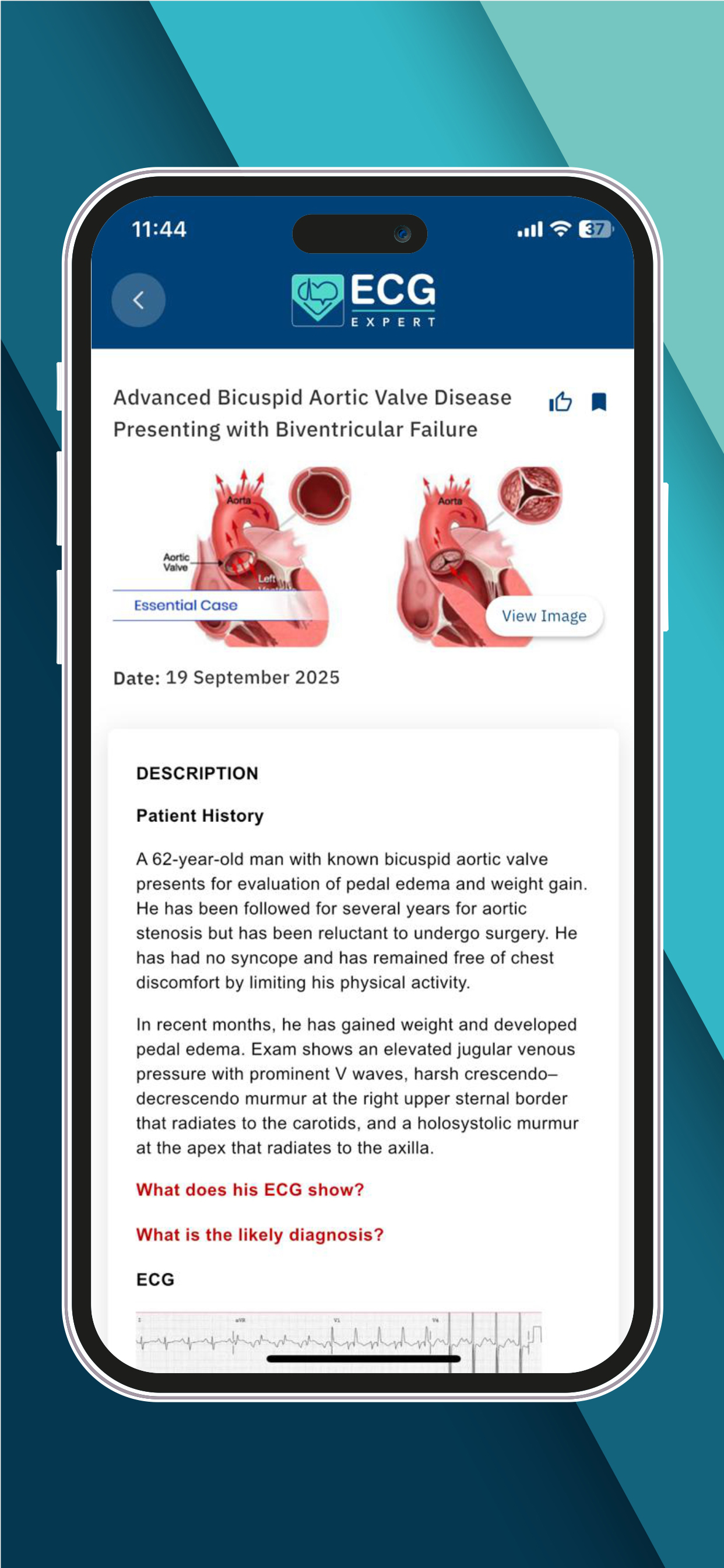 ECG Expert screenshot 3