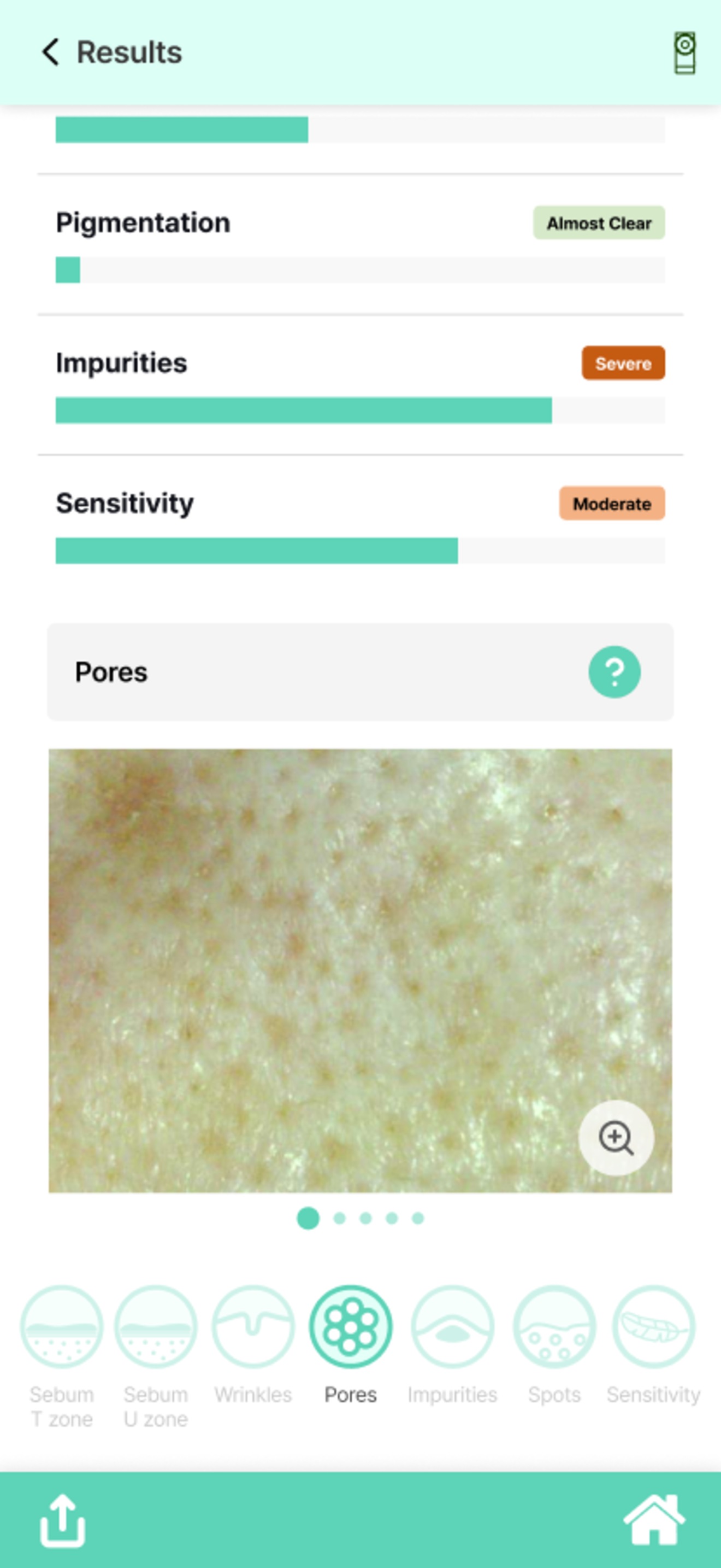 DermoPico Skin2