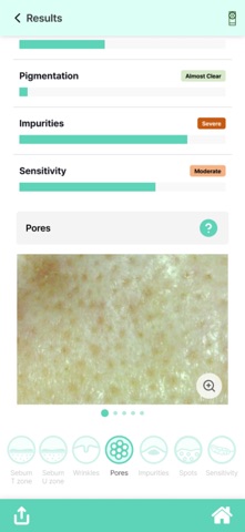 DermoPico Skin2 screenshot