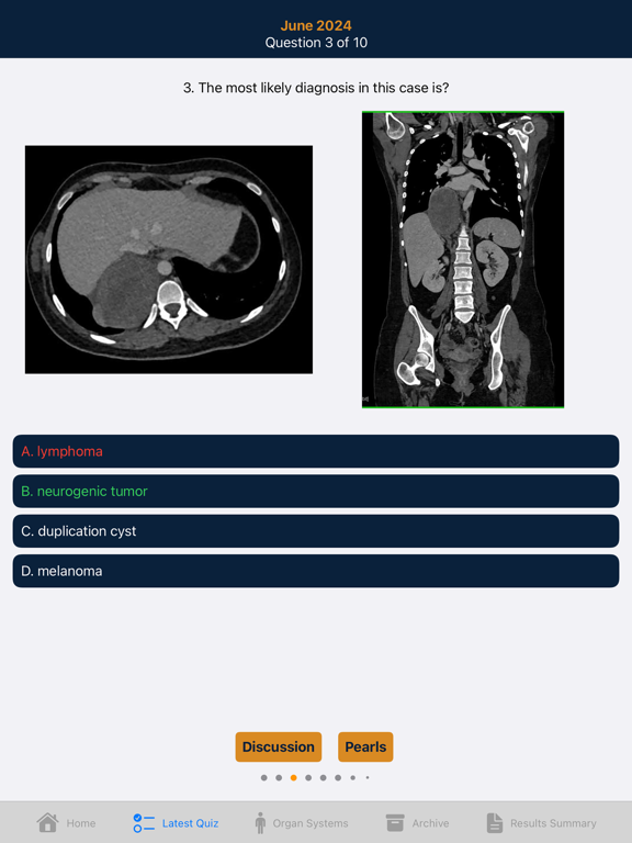 Screenshot #6 pour CTisus iQuiz 26