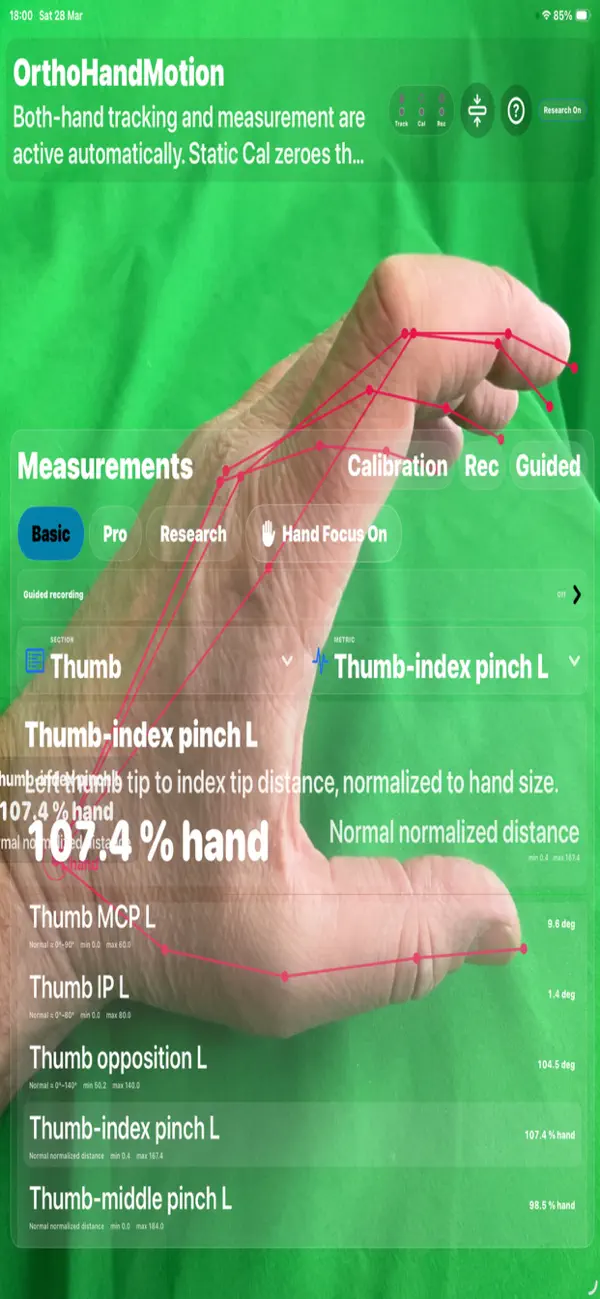 Screenshot #1 pour OrthoHandMotion