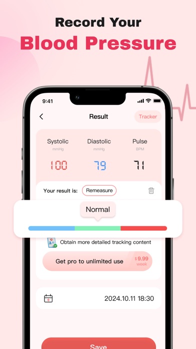 Screenshot #2 pour Blood Pressure APP-pulse track